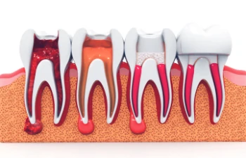 dentist in Ghatkopar east