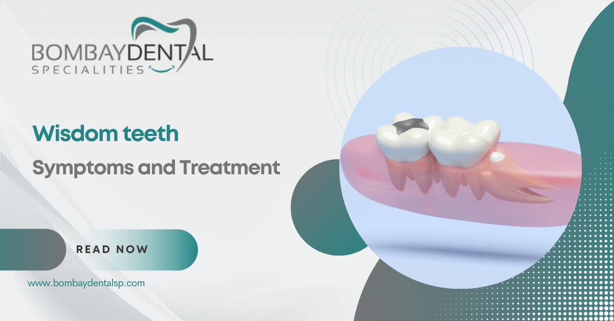 Wisdom Tooth Symptoms and Treatment