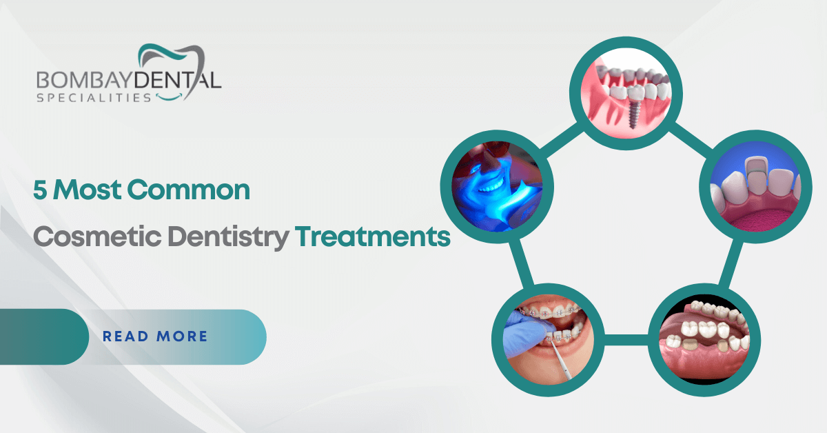 5 Most Common Cosmetic Dentistry Treatments