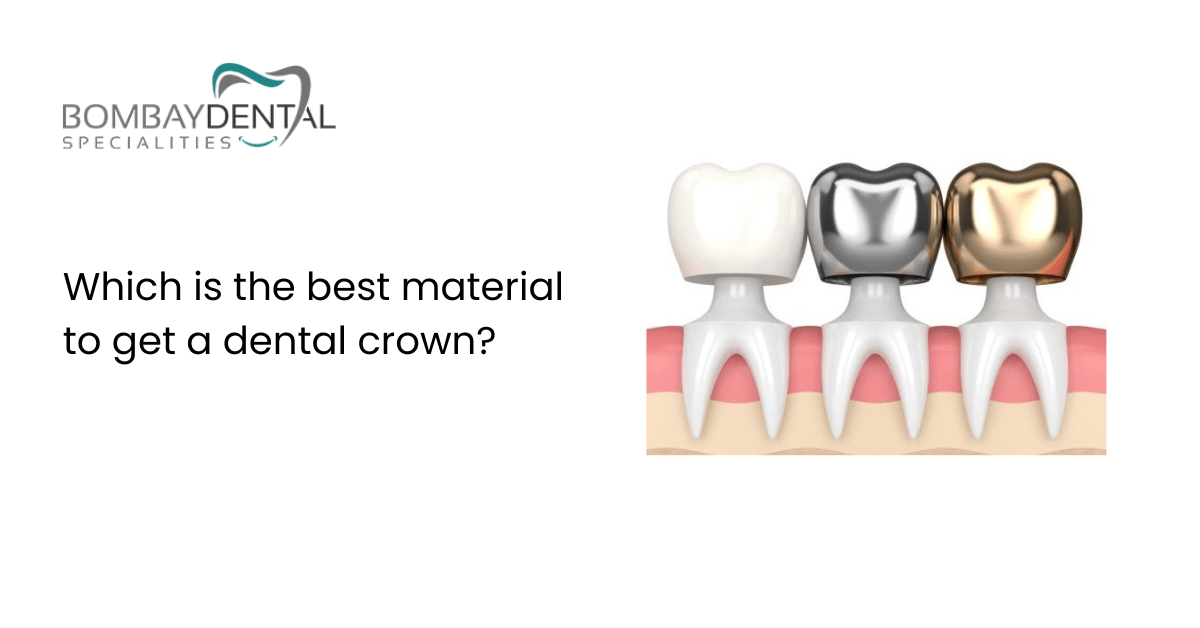 Denatl Crown