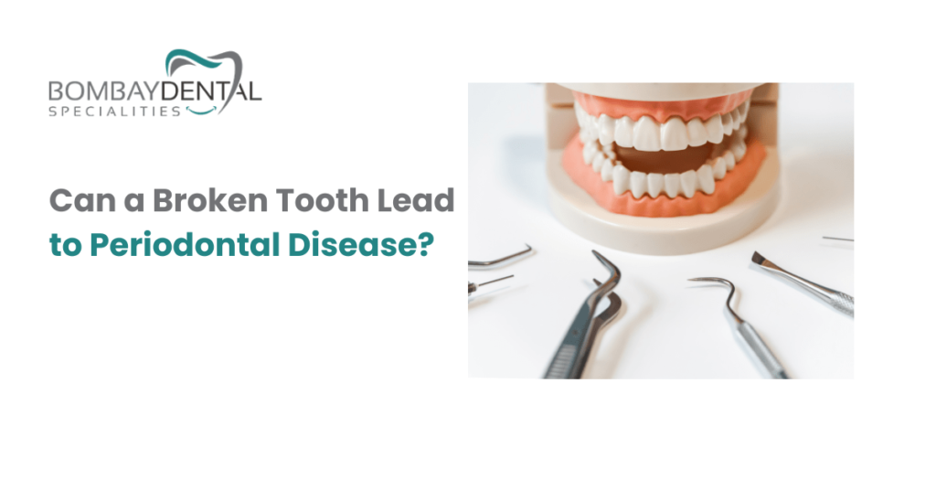 Periodontal Disease