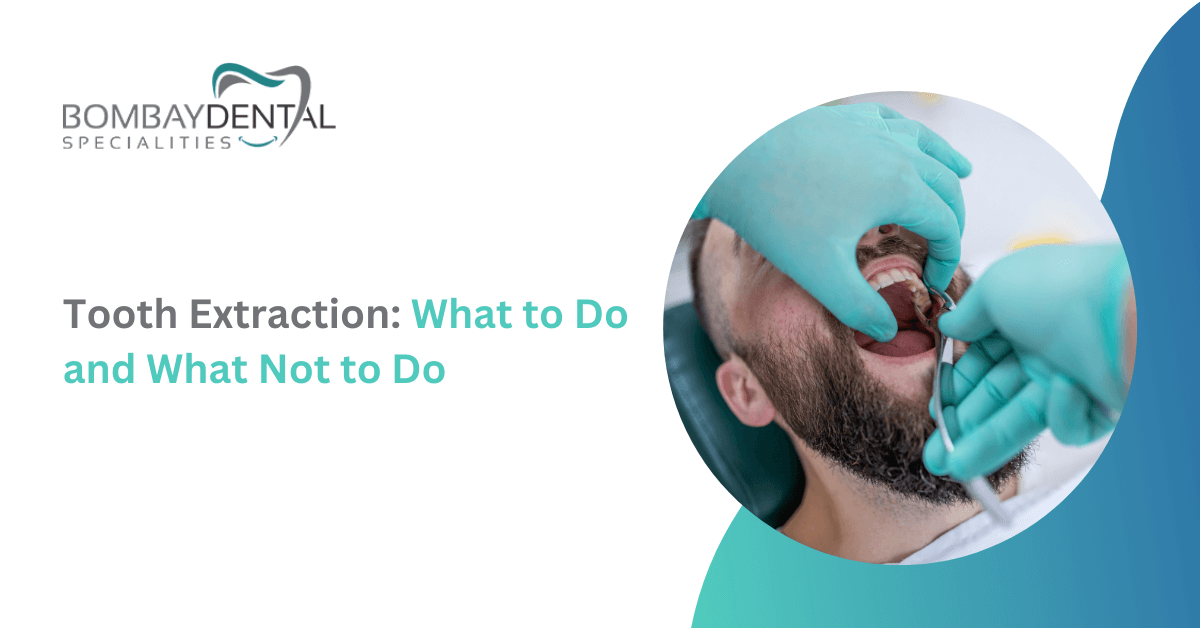 Tooth Extraction: What to Do and What Not to Do