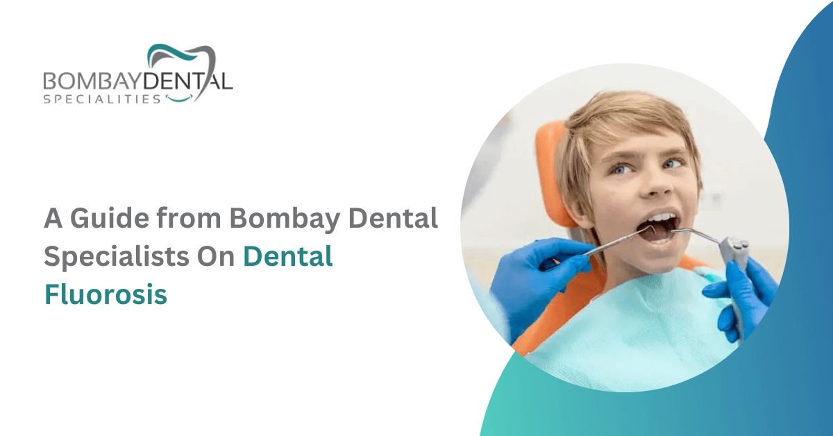 A Guide from Bombay Dental Specialists on Dental Fluorosis