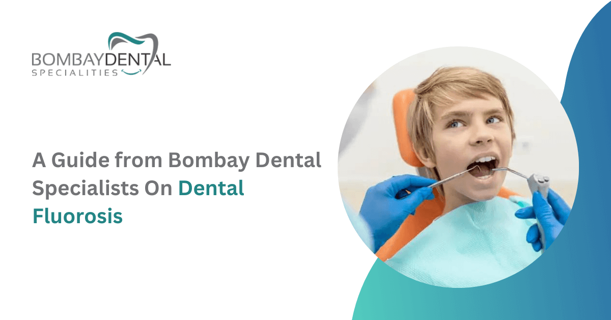 Fluorosis: Symptoms, Causes, and Treatments