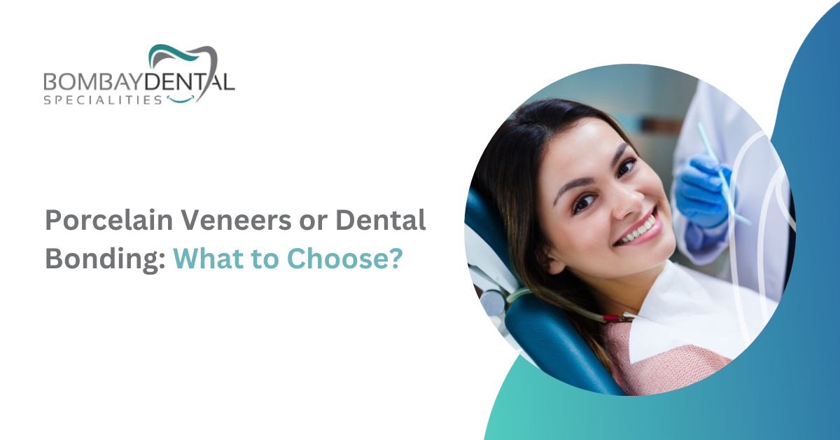 Porcelain Veneers or Dental Bonding: What to Choose?