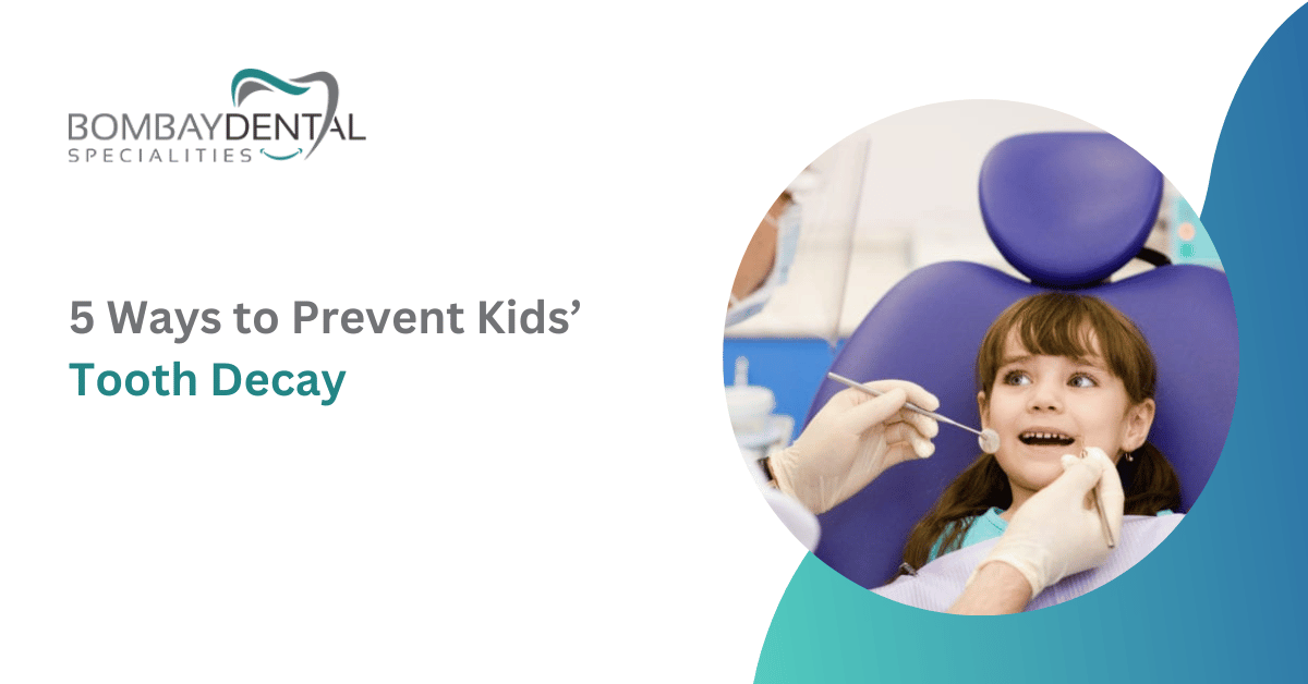 5 Ways to Prevent Kids’ Tooth Decay