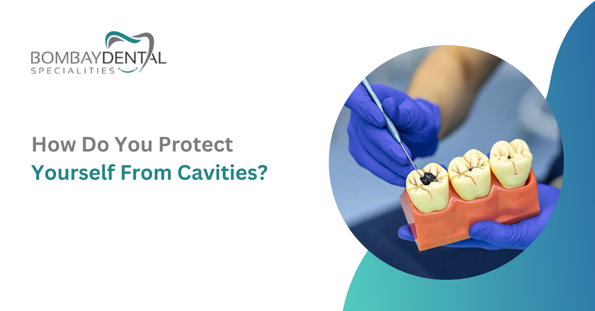 How Do You Protect Yourself From Cavities?