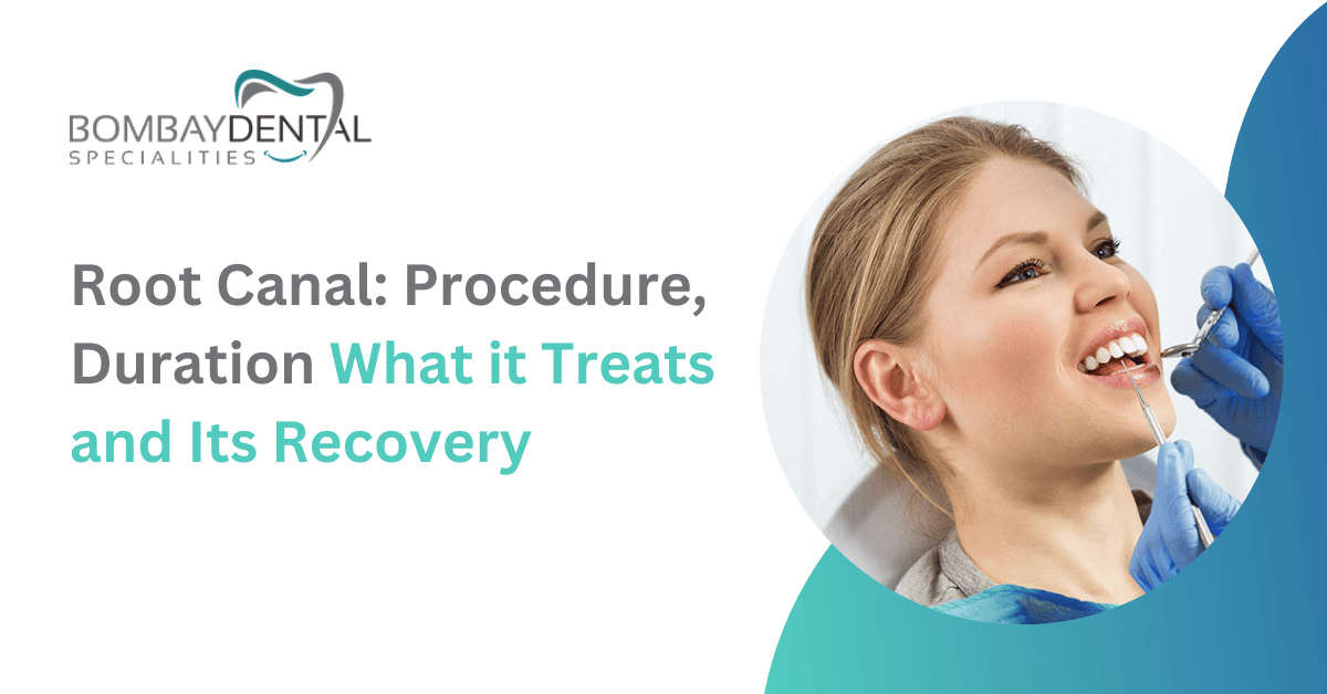 Root Canal: Procedure, Duration, What it Treats and Its Recovery