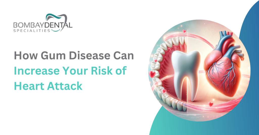 gum-disease-can-increase-risk-of-heart-attack