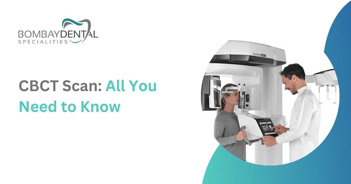 CBCT Scan: All You Need to Know