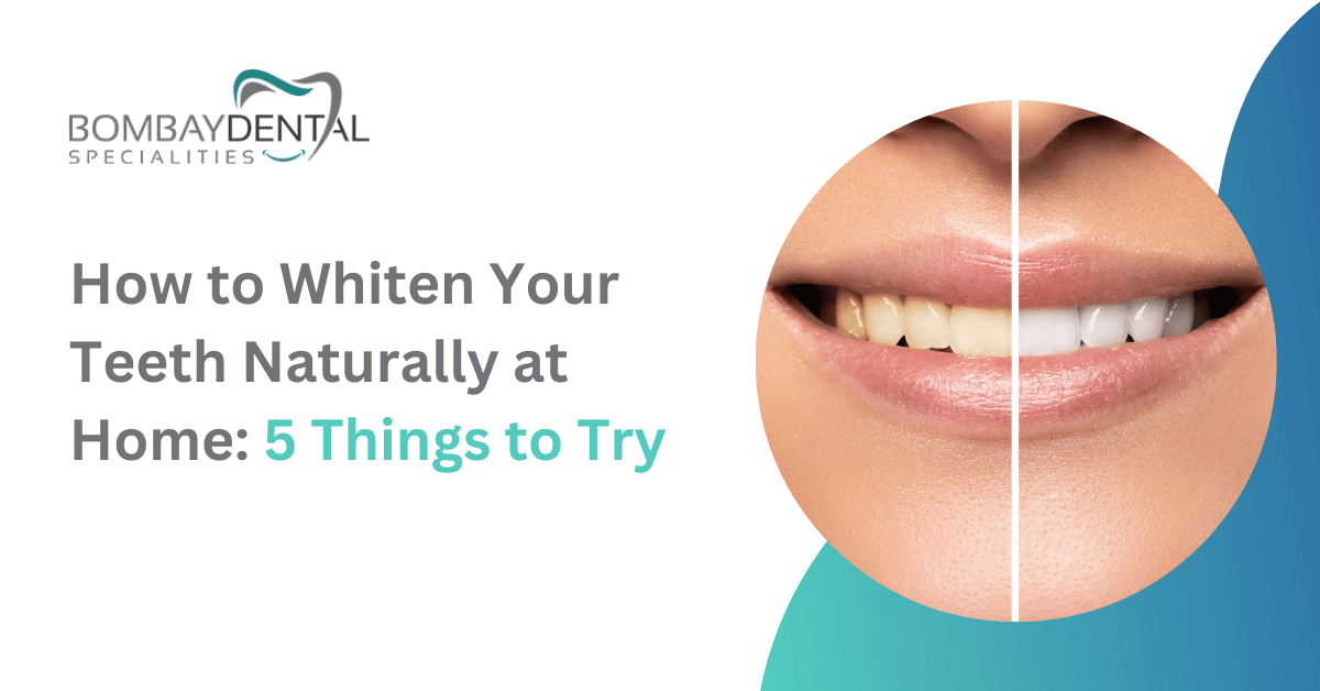 How to Whiten Your Teeth Naturally at Home: 5 Things to Try