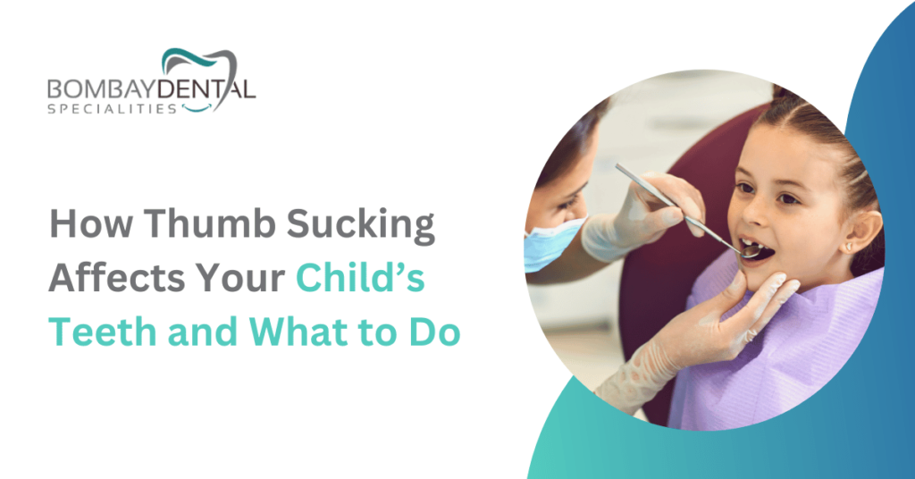 How Thumb Sucking Affects Your Child’s Teeth and What to Do