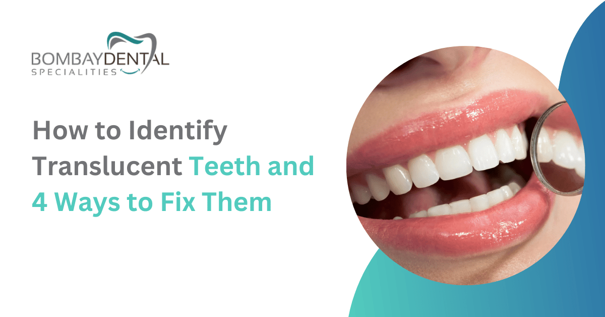 How to Identify Translucent Teeth and 4 Ways to Fix Them