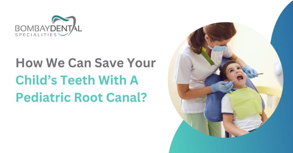 How We Can Save Your Child’s Teeth with a Pediatric Root Canal?