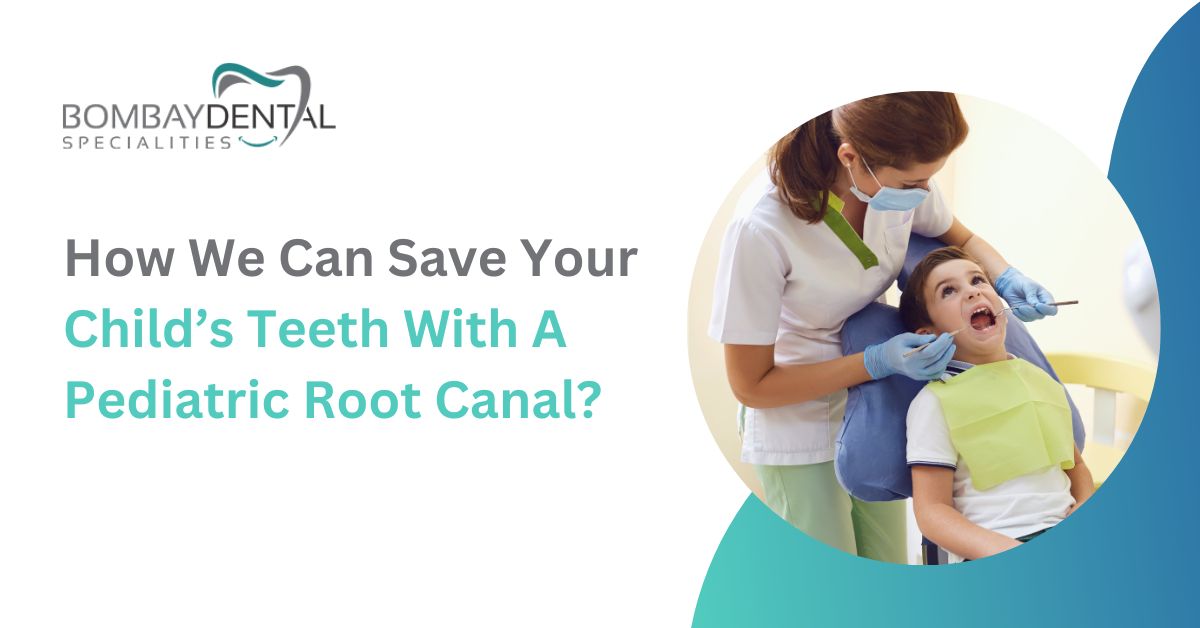 How We Can Save Your Child’s Teeth with a Pediatric Root Canal