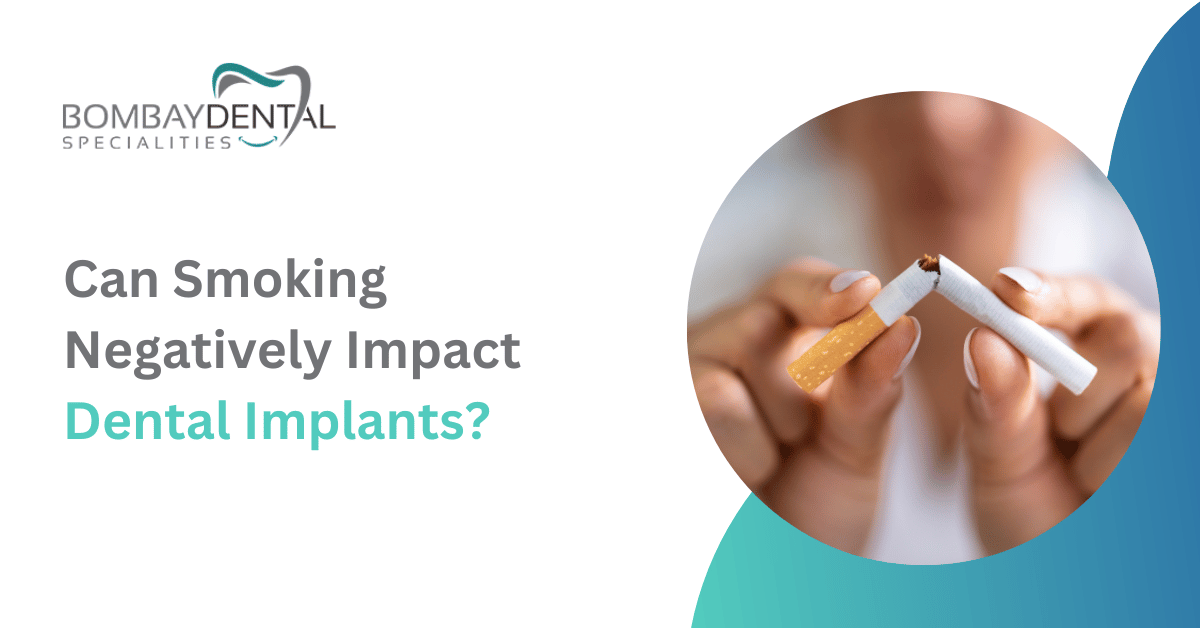 Can Smoking Negatively Impact Dental Implants?