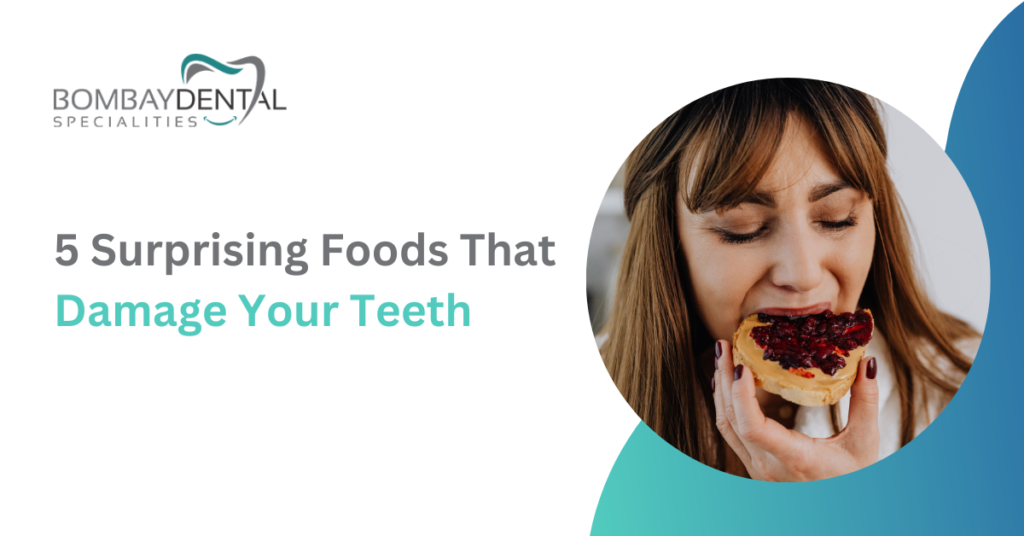 5 Surprising Foods That Damage Your Teeth