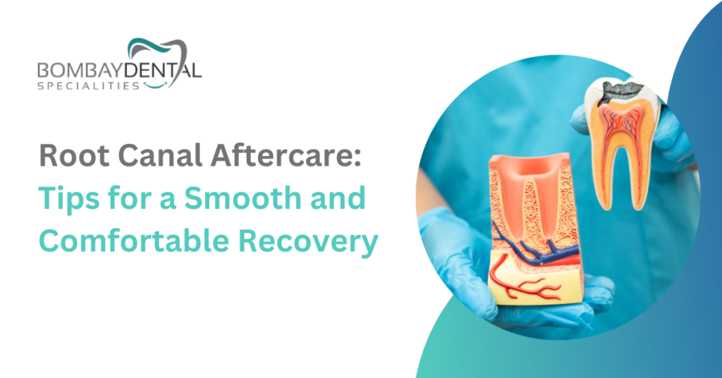 Root Canal