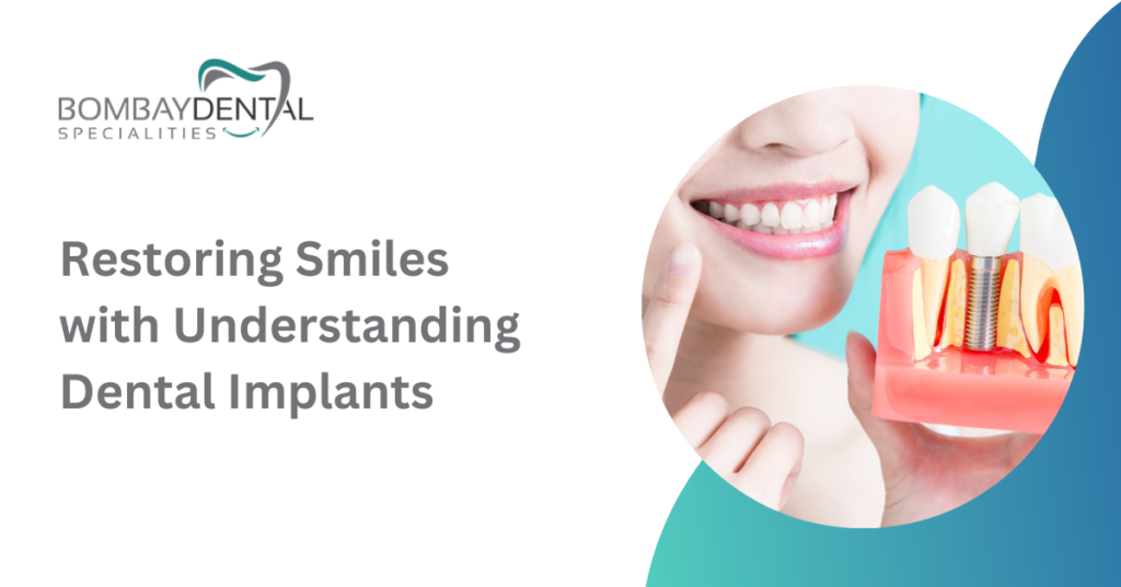 Restoring Smiles with Understanding Dental Implants